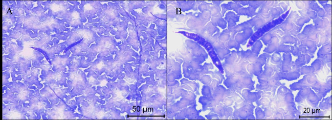 Litomosoides brasiliensis (Nematoda: Onchocercidae) infecting chiropterans in the Legal Amazon region, Brazil.