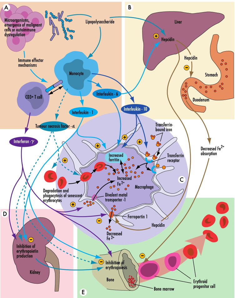 Hematinic and Iron Optimization in Peri-operative Anemia and Iron Deficiency.