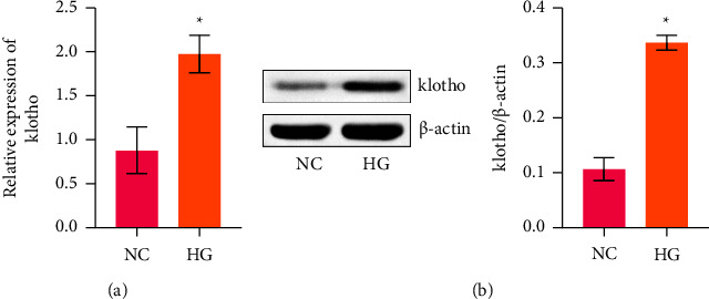 Upregulation of Klotho Aggravates Insulin Resistance in Gestational Diabetes Mellitus Trophoblast Cells.