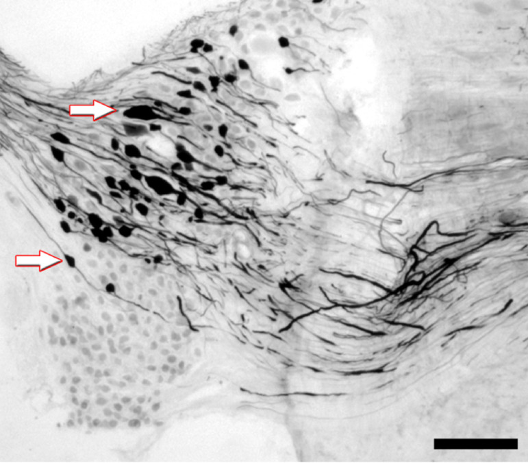 Pigeon as a model to study peripheral projections from the horizontal semicircular canal vestibular apparatus to a brainstem target immunoreactive for AMPA.