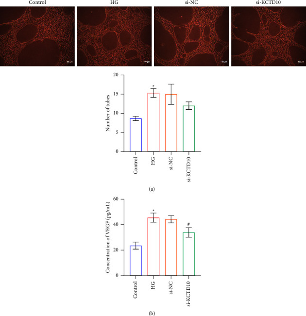 Inhibition of KCTD10 Affects Diabetic Retinopathy Progression by Reducing VEGF and Affecting Angiogenesis.