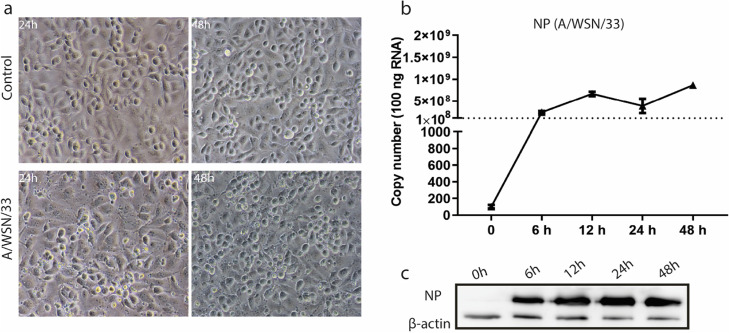 Altered gene expression in human brain microvascular endothelial cells in response to the infection of influenza H1N1 virus.