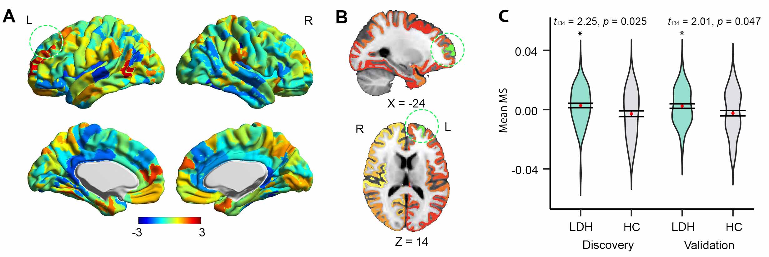 Morphometric similarity networks discriminate patients with lumbar disc herniation from healthy controls and predict pain intensity.