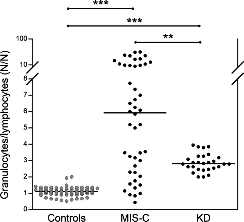 Immunophenotyping of peripheral blood cells allows to discriminate MIS-C and Kawasaki disease.