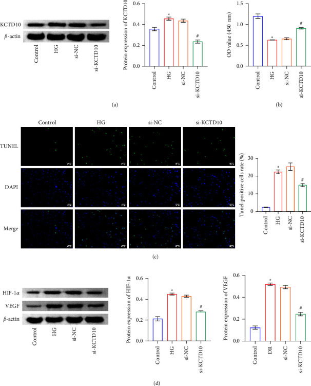 Inhibition of KCTD10 Affects Diabetic Retinopathy Progression by Reducing VEGF and Affecting Angiogenesis.