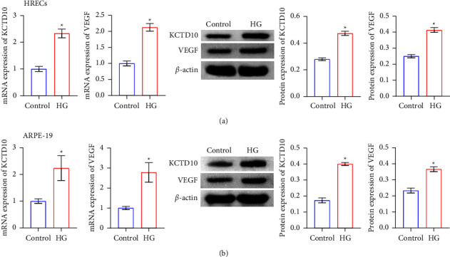 Inhibition of KCTD10 Affects Diabetic Retinopathy Progression by Reducing VEGF and Affecting Angiogenesis.