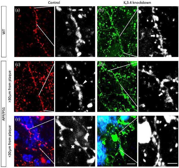 Reducing voltage-dependent potassium channel Kv3.4 levels ameliorates synapse loss in a mouse model of Alzheimer's disease.