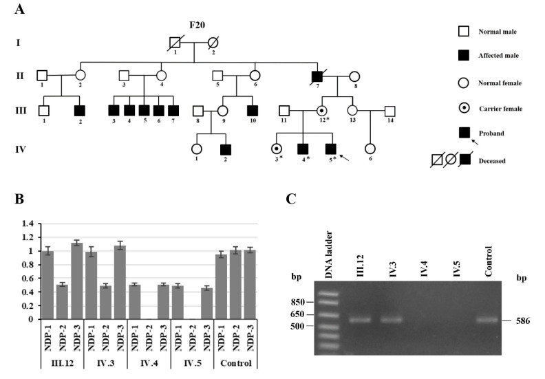 Whole exome sequencing revealed novel pathogenic variants in Vietnamese patients with FEVR.