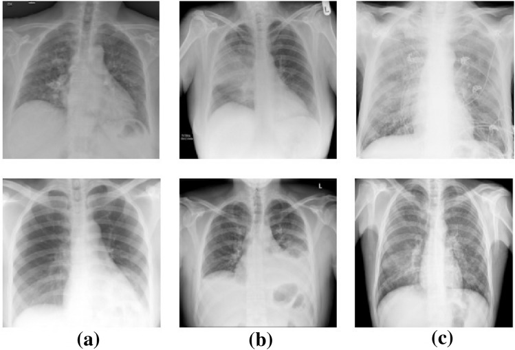 Content-based medical image retrieval system for lung diseases using deep CNNs.