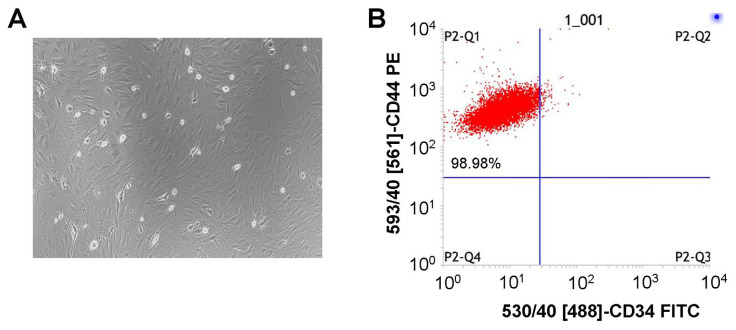 Bone marrow mesenchymal stem cells attenuate LPS-induced acute lung injury in mice by promoting RvE1/ProD1 and modulating Treg/Th17 balance.