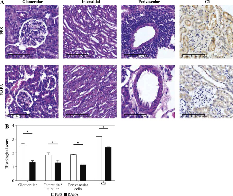 Rapamycin relieves lupus nephritis by regulating TIM-3 and CD4<sup>+</sup>CD25<sup>+</sup>Foxp3<sup>+</sup> Treg cells in an MRL/lpr mouse model.