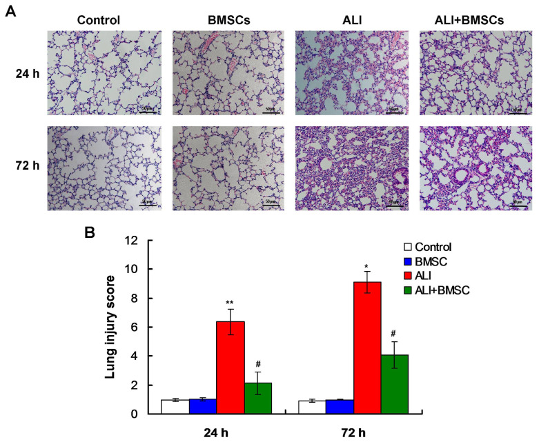 Bone marrow mesenchymal stem cells attenuate LPS-induced acute lung injury in mice by promoting RvE1/ProD1 and modulating Treg/Th17 balance.