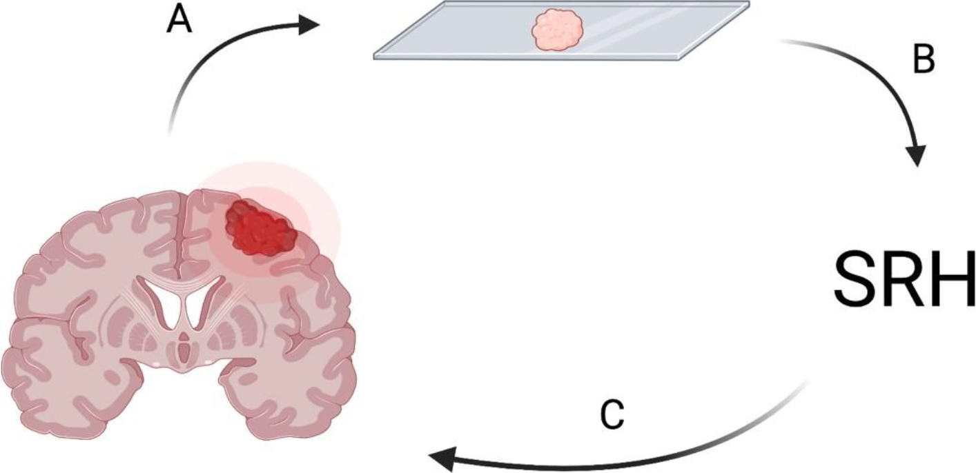 Innovation in Neurosurgery: Lessons Learned, Obstacles, and Potential Funding Sources.