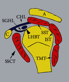 Imaging Review of Subscapularis Tendon and Rotator Interval Pathology.