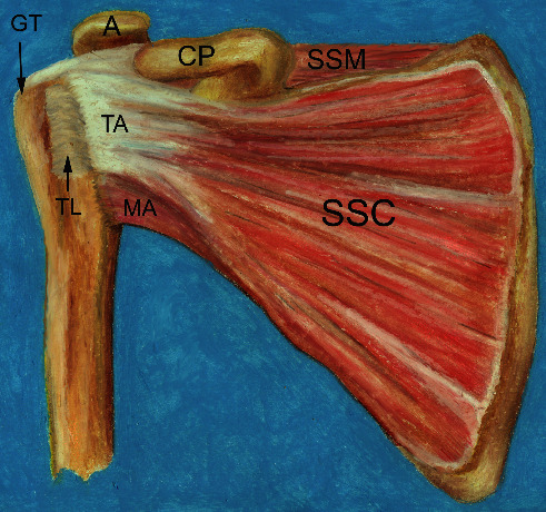 Imaging Review of Subscapularis Tendon and Rotator Interval Pathology.