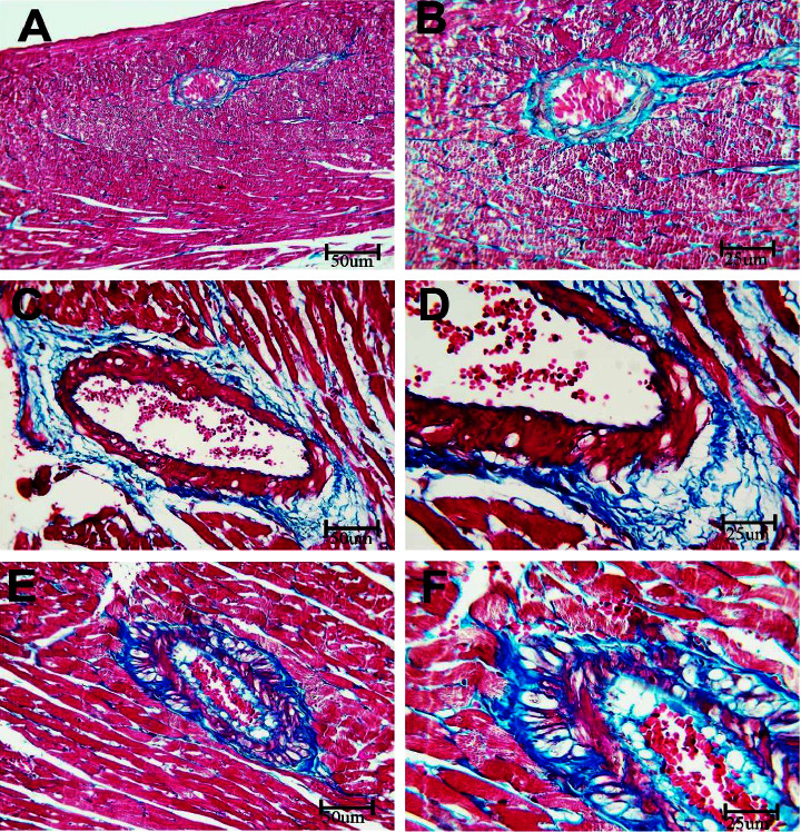 Potential Effects of Bisphenol A on the Heart and Coronary Artery of Adult Male Rats and the Possible Role of L-Carnitine.