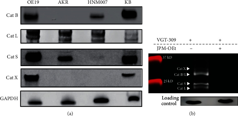 Preclinical Evaluation of an Activity-Based Probe for Intraoperative Imaging of Esophageal Cancer.