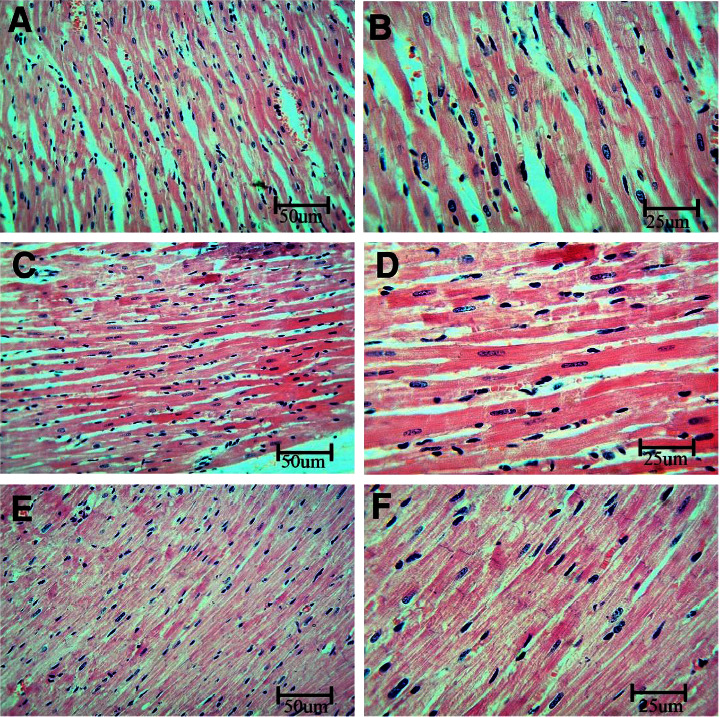 Potential Effects of Bisphenol A on the Heart and Coronary Artery of Adult Male Rats and the Possible Role of L-Carnitine.