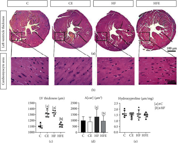 Empagliflozin Alleviates Left Ventricle Hypertrophy in High-Fat-Fed Mice by Modulating Renin Angiotensin Pathway.