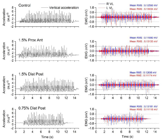 Effects of wearable resistance load placement on neuromuscular activity and stride kinematics: A preliminary study.