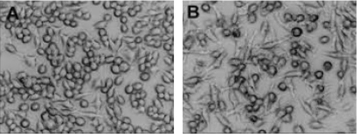 Identifying the presence of bacteria on digital images by using asymmetric distribution with k-means clustering algorithm.