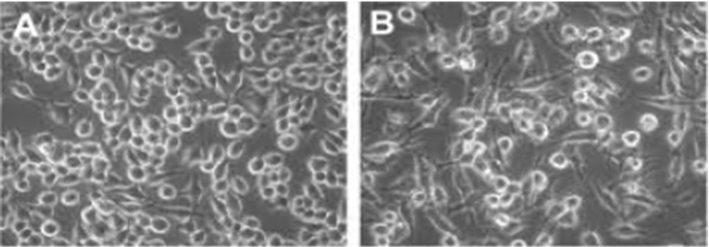 Identifying the presence of bacteria on digital images by using asymmetric distribution with k-means clustering algorithm.