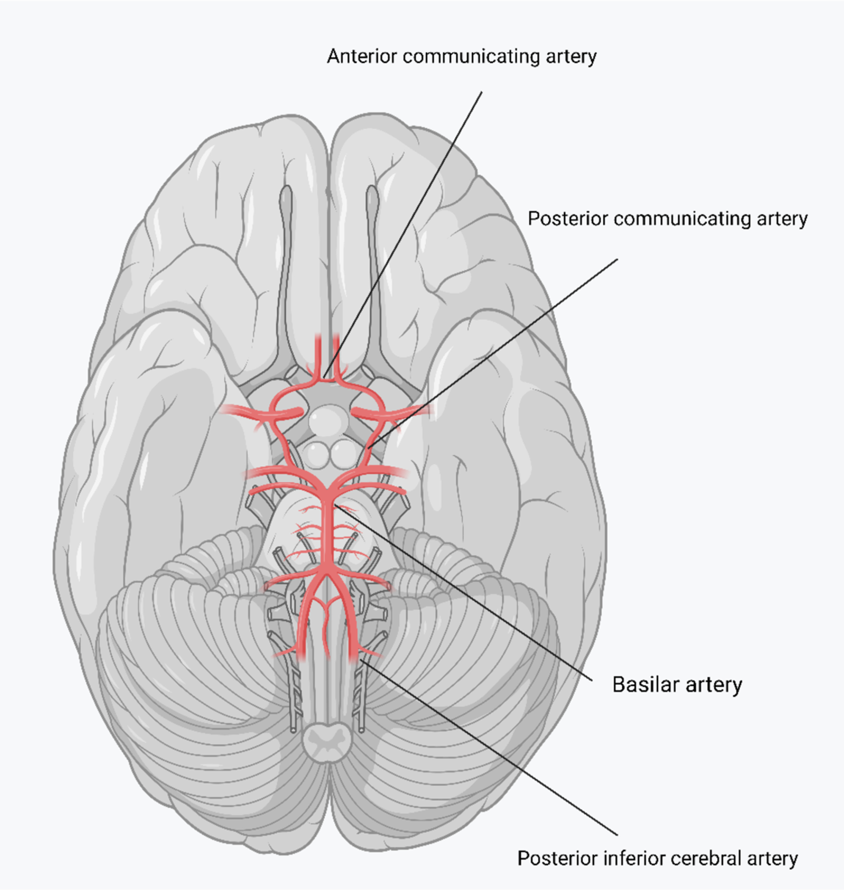 Exploration of treatments for subarachnoid hemorrhage.