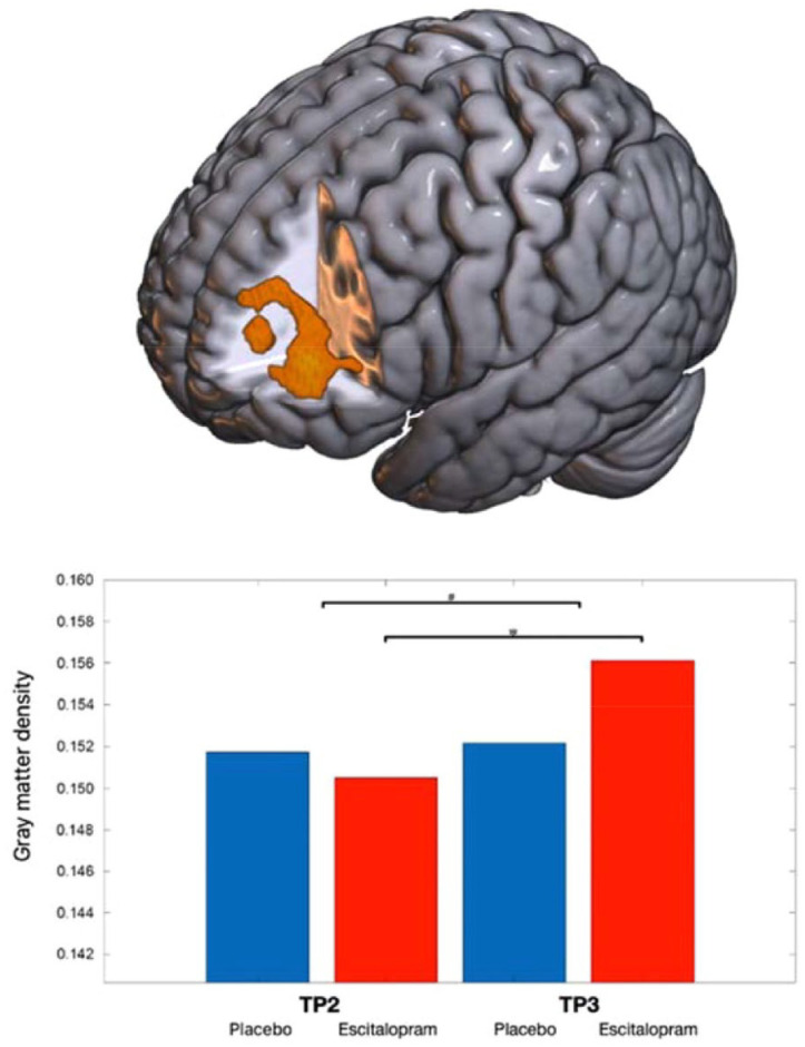 Increased left dorsolateral prefrontal cortex density following escitalopram intake during relearning: a randomized, placebo-controlled trial in healthy humans.