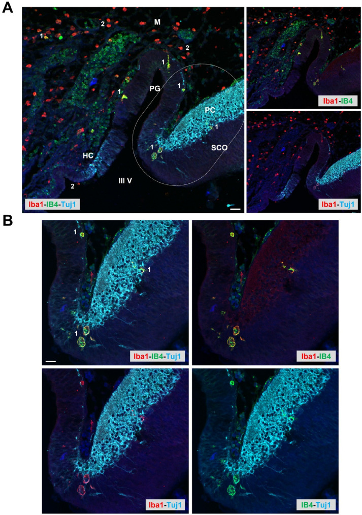 Microglia in Circumventricular Organs: The Pineal Gland Example.