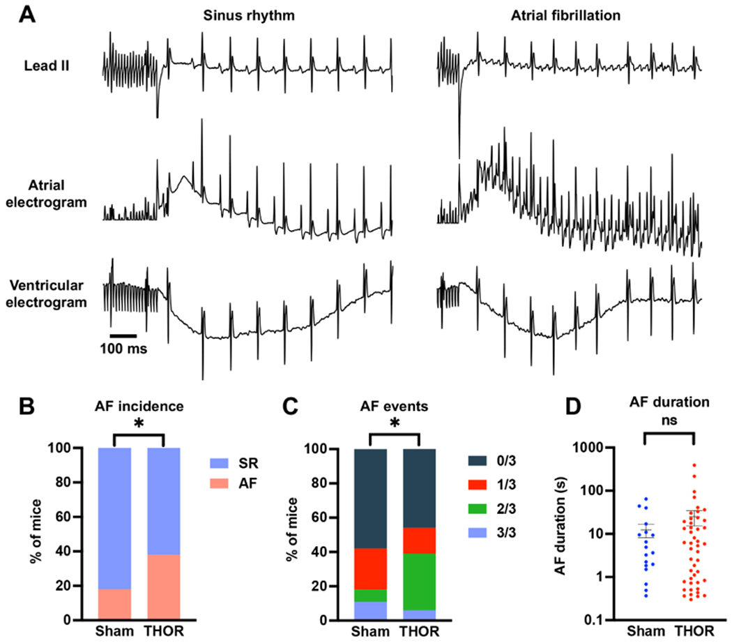 In-depth characterization of a mouse model of postoperative atrial fibrillation.