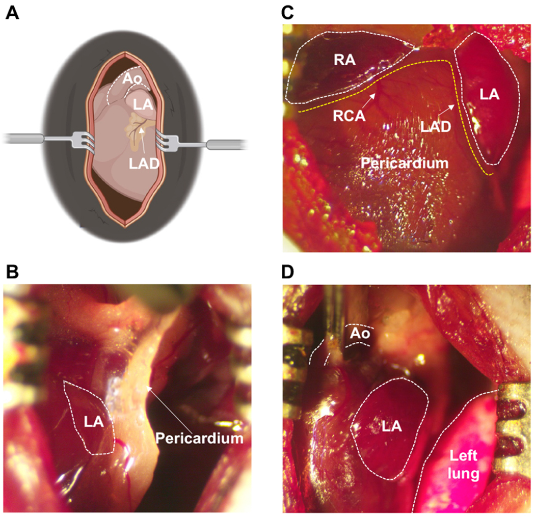 In-depth characterization of a mouse model of postoperative atrial fibrillation.