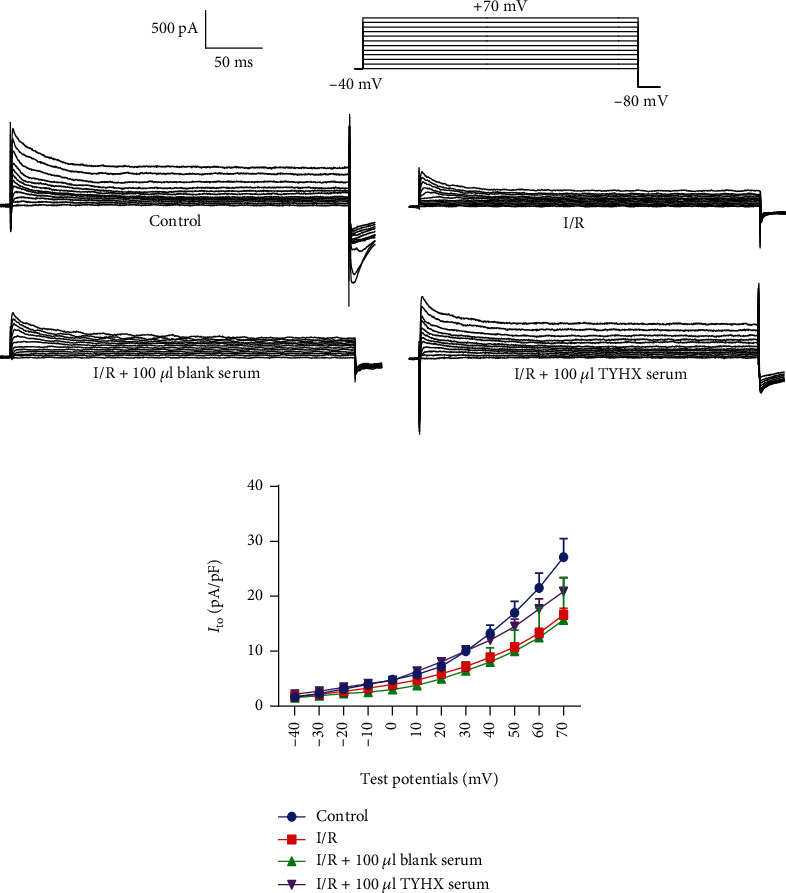 The Effect of the Tongyang Huoxue Recipe (TYHX) on the <i>I</i> <sub>to</sub>/<i>I</i> <sub>Kur</sub> in Ischemia/Reperfusion Sinoatrial Node Cells.