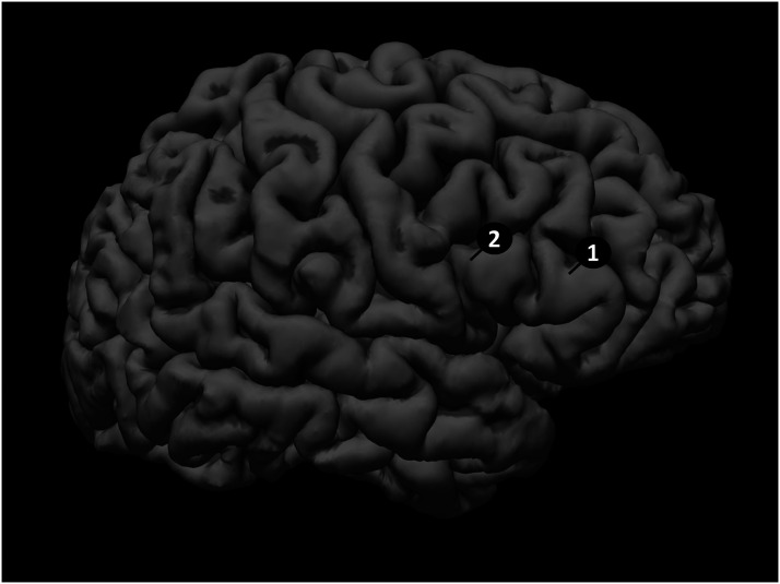 Reduced Interference and Serial Dependency Effects for Naming in Older but Not Younger Adults after 1 Hz rTMS of Right Pars Triangularis.