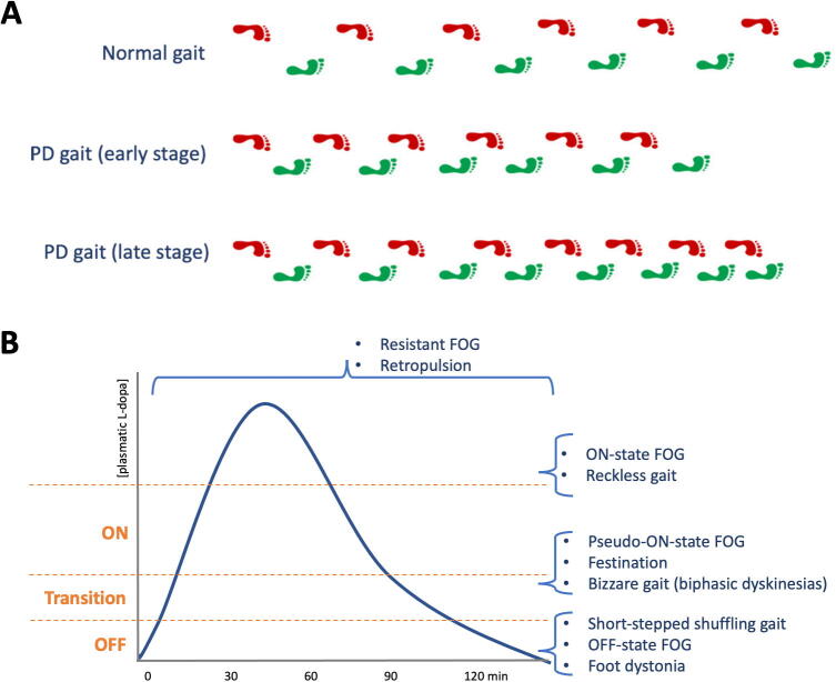 Clinical neurophysiology of Parkinson’s disease and parkinsonism