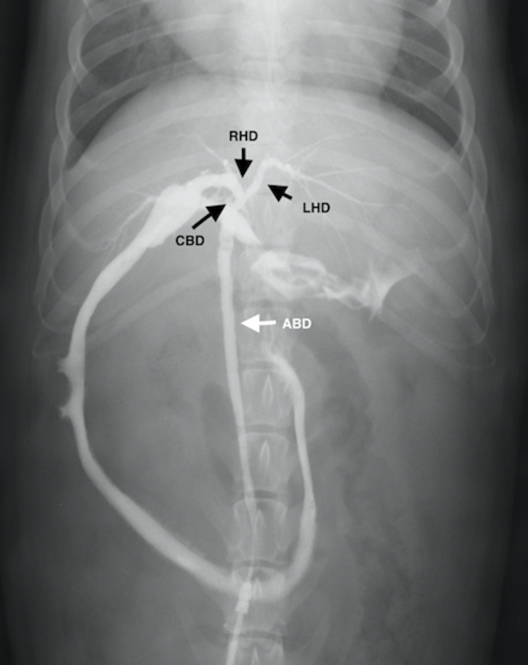 A case of a congenital umbilicobiliary fistula associated with gallbladder agenesis in a dog.