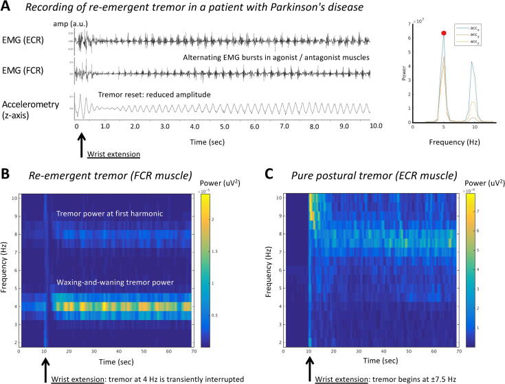 Clinical neurophysiology of Parkinson’s disease and parkinsonism