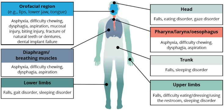 Current perspectives on the epidemiology and burden of tardive dyskinesia: a focused review of the clinical situation in Japan.