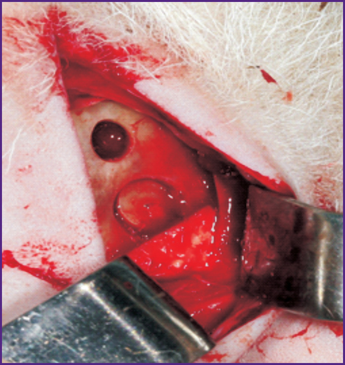 The Comparison of Methods for Bone Reconstruction in the Anterior Wall of the Maxillary Sinus (an Experimental Study).