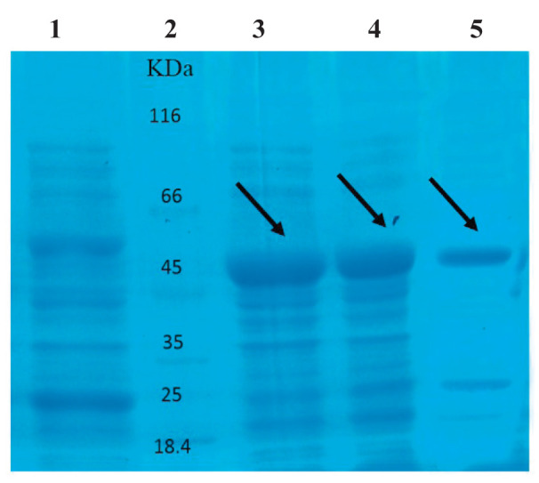 Recombinant Production of a Mutant Form of Soluble IL-6 Receptor with Inhibitory Effects against Interleukin-6.