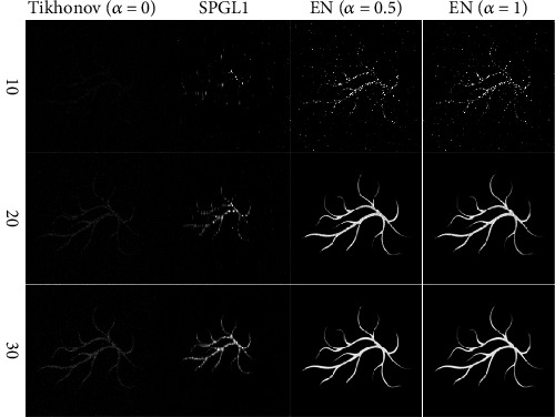 Compressed Sensing Photoacoustic Imaging Reconstruction Using Elastic Net Approach.