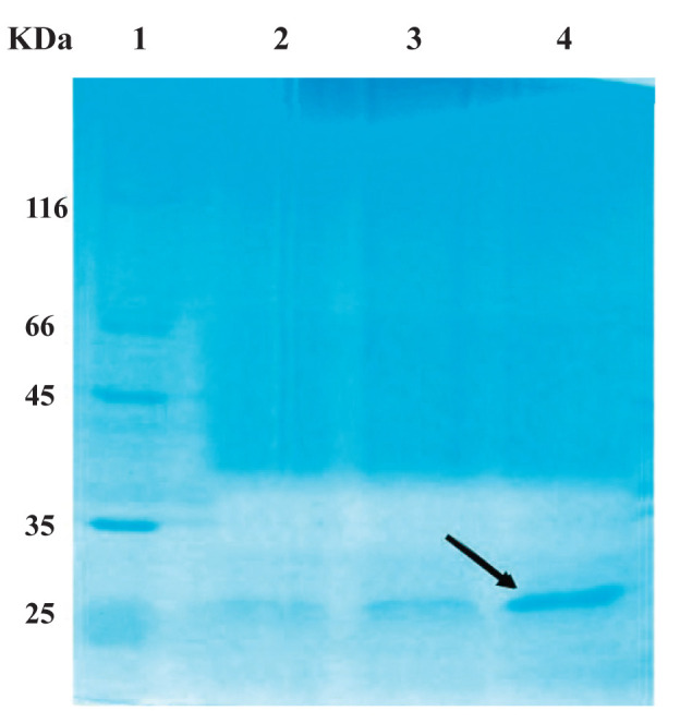 Recombinant Production of a Mutant Form of Soluble IL-6 Receptor with Inhibitory Effects against Interleukin-6.