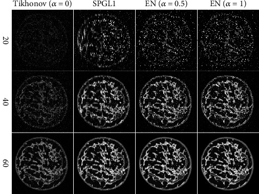 Compressed Sensing Photoacoustic Imaging Reconstruction Using Elastic Net Approach.