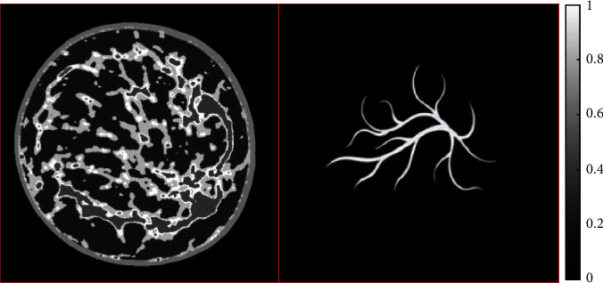 Compressed Sensing Photoacoustic Imaging Reconstruction Using Elastic Net Approach.