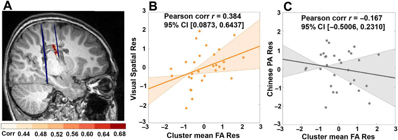 Left and Right Arcuate Fasciculi Are Uniquely Related to Word Reading Skills in Chinese-English Bilingual Children.