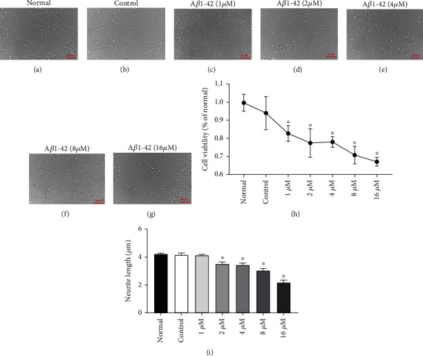 Reduced Expression of Voltage-Gated Sodium Channel Beta 2 Restores Neuronal Injury and Improves Cognitive Dysfunction Induced by A<i>β</i>1-42.