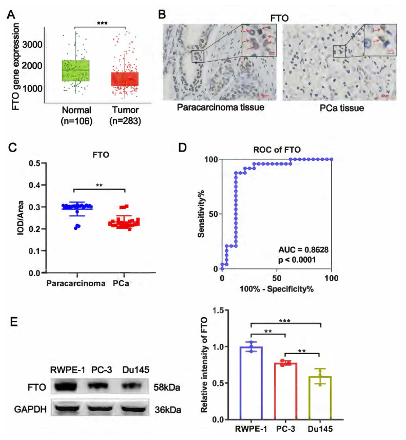 Demethylase FTO inhibits the development of prostate cancer by upregulating EGR2 expression in an m6A manner.