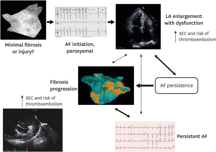 Left Atrial Dysfunction, Fibrosis and the Risk of Thromboembolism in Patients With Paroxysmal and Persistent Atrial Fibrillation.