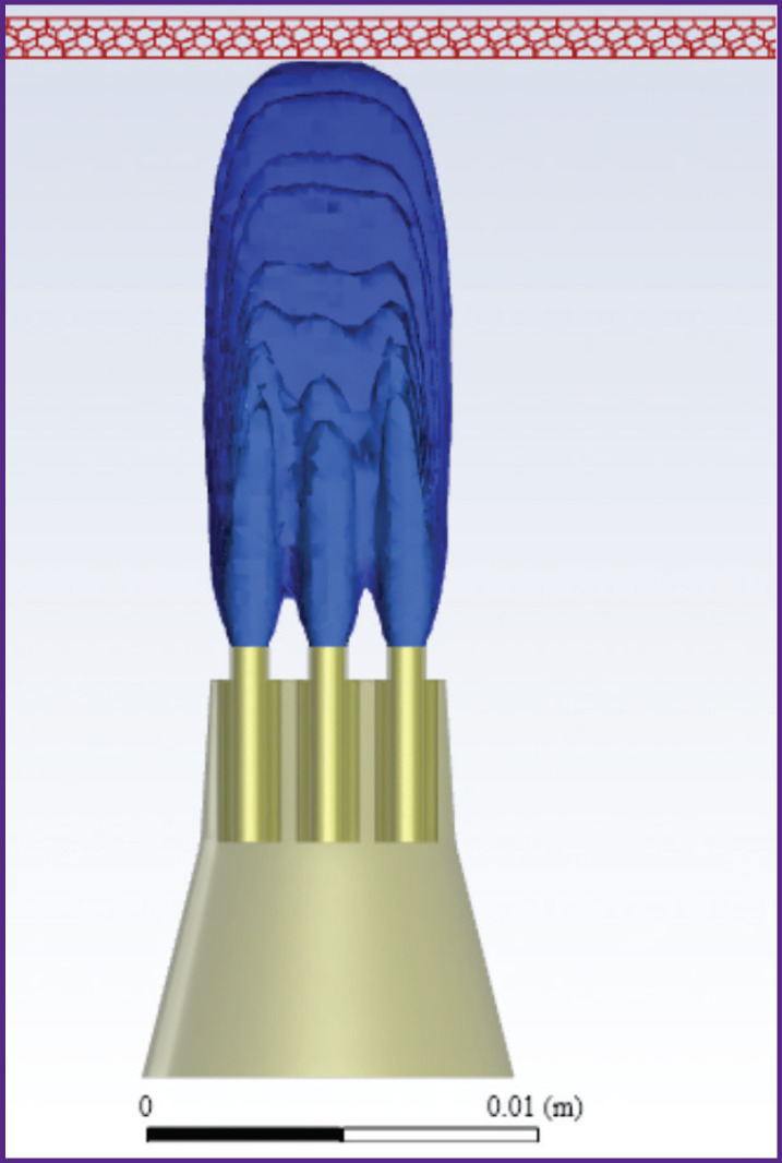 Application of Barophoresis in Chronic Generalized Periodontitis: a Mathematical Substantiation.