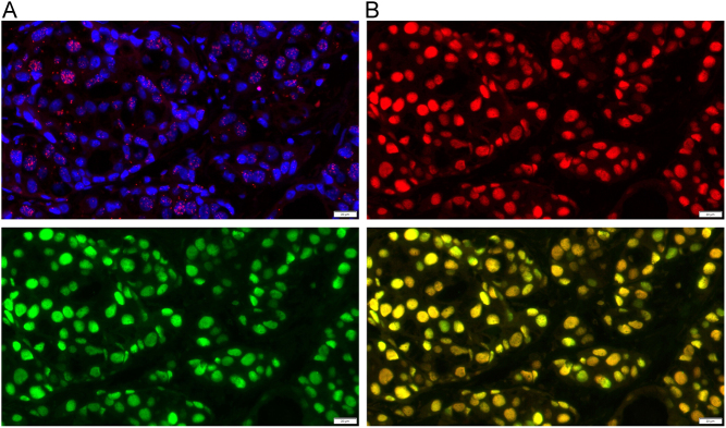 Visualization of the protein-protein interactions of hormone receptors in hormone-dependent cancer research.