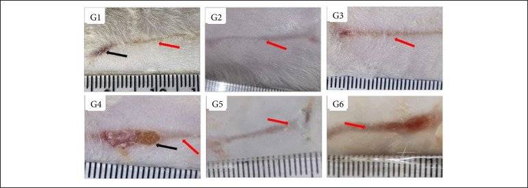 Treatment of experimentally induced partial-thickness burns in rats with different silver-impregnated dressings.